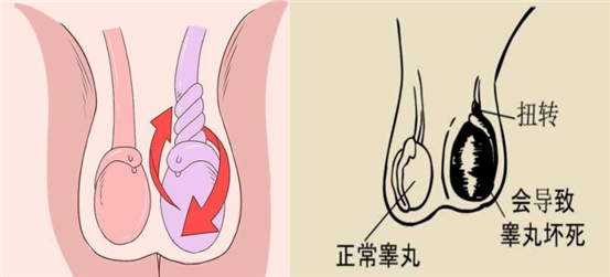 C:\Users\Administrator\Desktop\睪丸扭轉(zhuǎn)\微信圖片_20211220201931.png